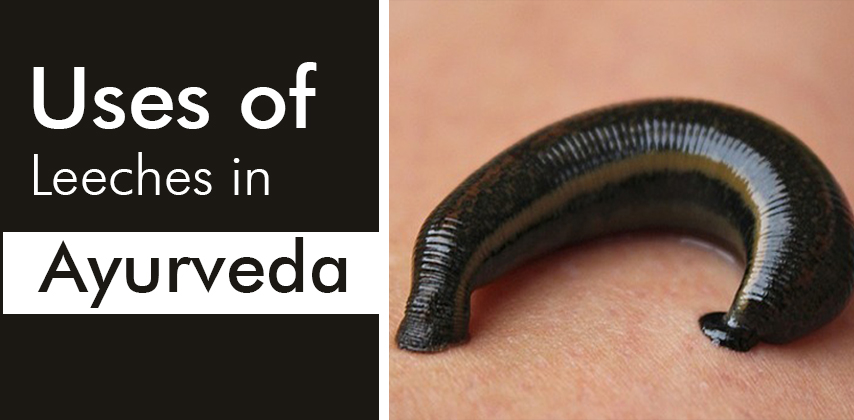 JALAUKA VIDHI: Use of Leeches in Ayurveda – Om Pharma Ayur